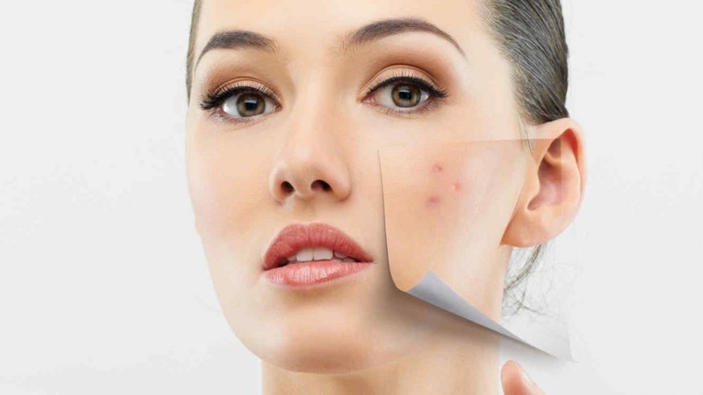 Esto es lo que le pasa a tu piel si dejas el chocolate 157 Lo que verdaderamente afecta chocolate piel