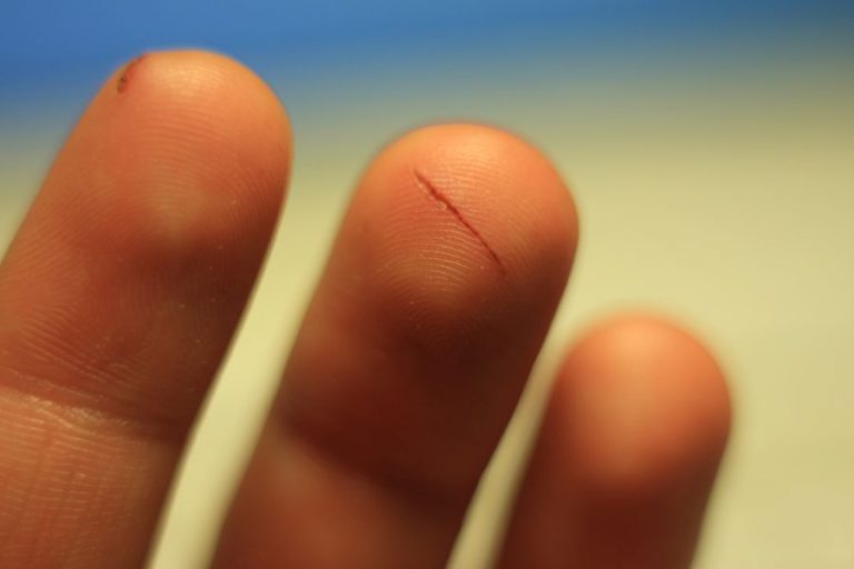 Por qué cortarte con un papel duele tanto