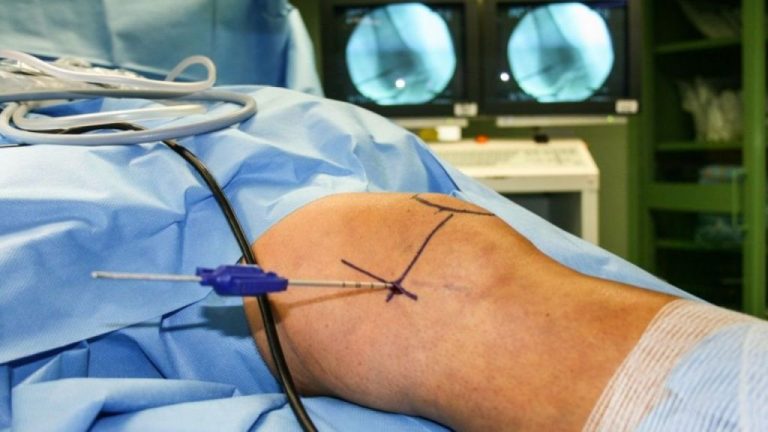 El Clínico San Carlos de Madrid realiza los primeros implantes de prótesis de rodilla con cirugía robótica en España