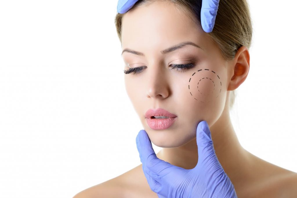 Qué es bichectomía 5 Necesitas algun requisito para hacerte una bichectomía