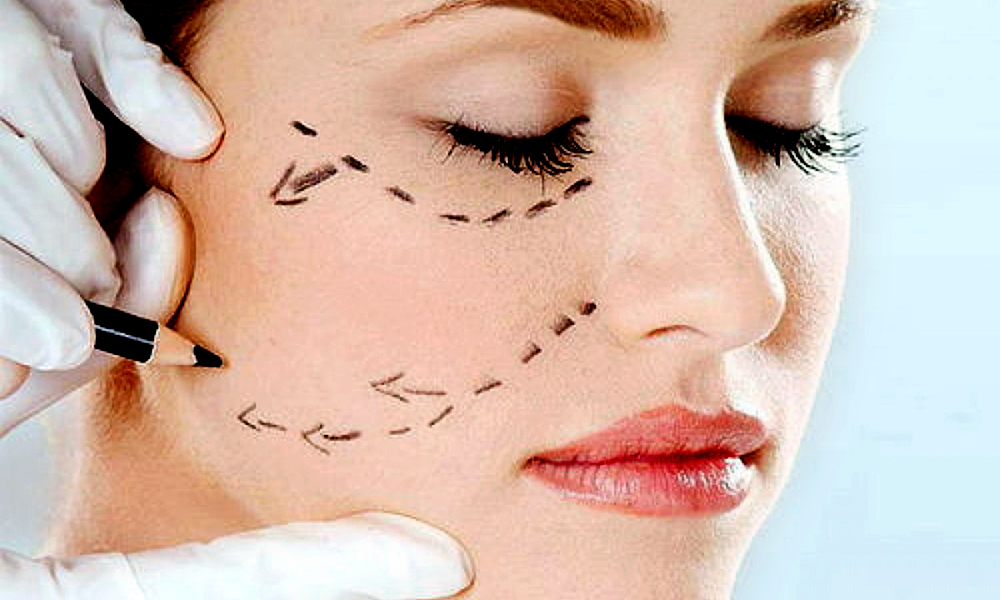 Qué es bichectomía 8 Le brinda a tu rostro un aspecto más delicado