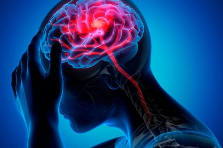 Cómo quitar el dolor de cabeza