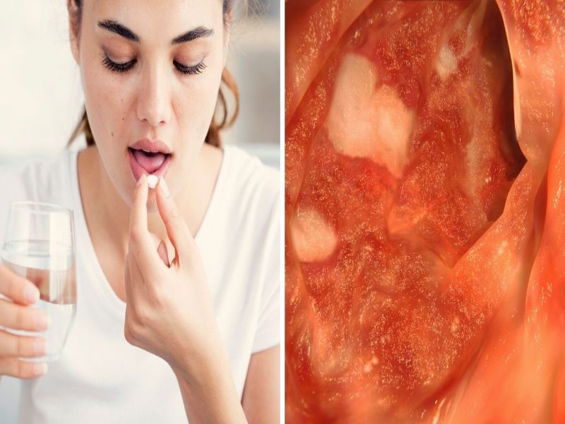 efectos secundario del antibiótico