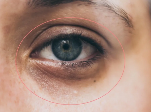 Cómo eliminar las ojeras de tu rostro de manera fulminante Cómo eliminar las ojeras de tu rostro de manera fulminante