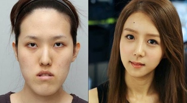 12 casos de cirugía plástica extrema