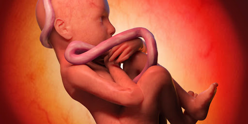 Placenta adherida: 