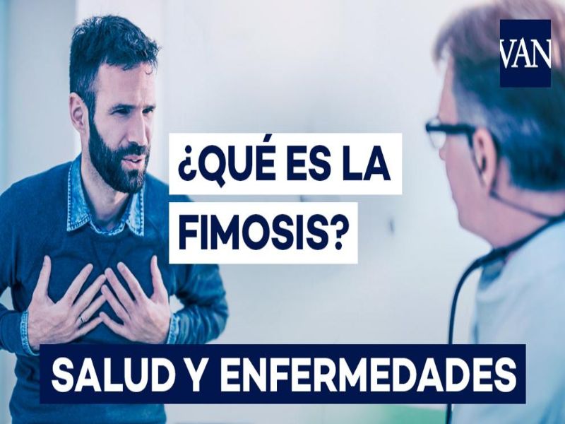 Qué es la fimosis 3 sintomas que genera la fimosis