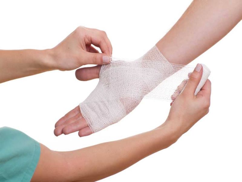 Cómo curar una quemadura 2 que hacer si tienes una quemadura