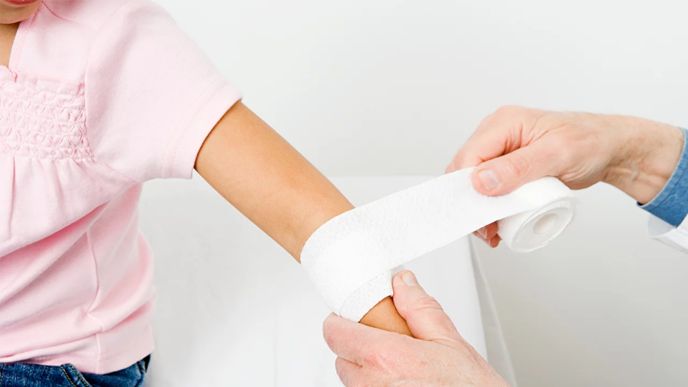 Cómo curar quemaduras 5 Tratamiento de las quemaduras