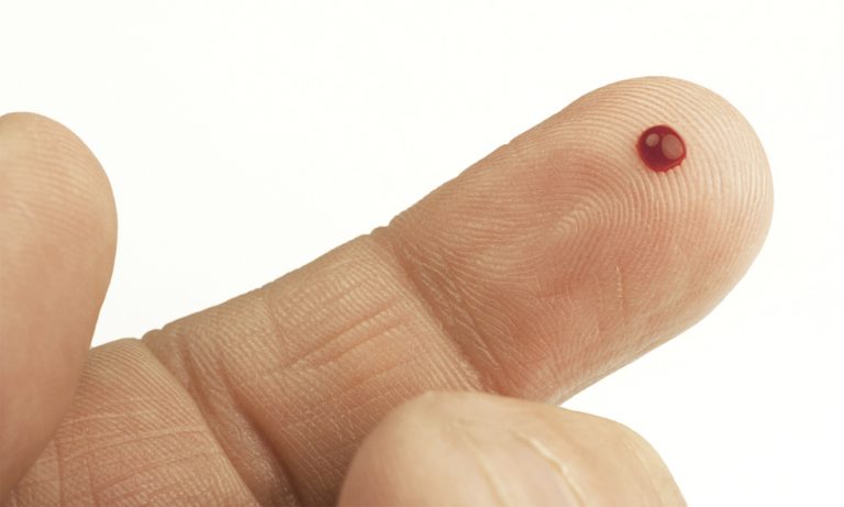 Cómo quitar las manchas de sangre