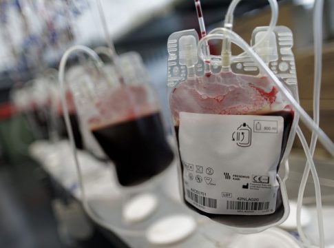 sangre diabetes covid Mucha azúcar en sangre aumentaría la mortalidad en pacientes Covid no diabéticos