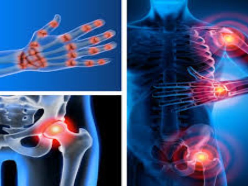 Qué es la artrosis 1 síntomas