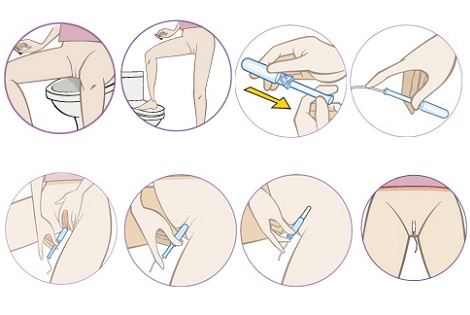 Cómo ponerse un tampón 1 ¿Cómo usar un tampón?