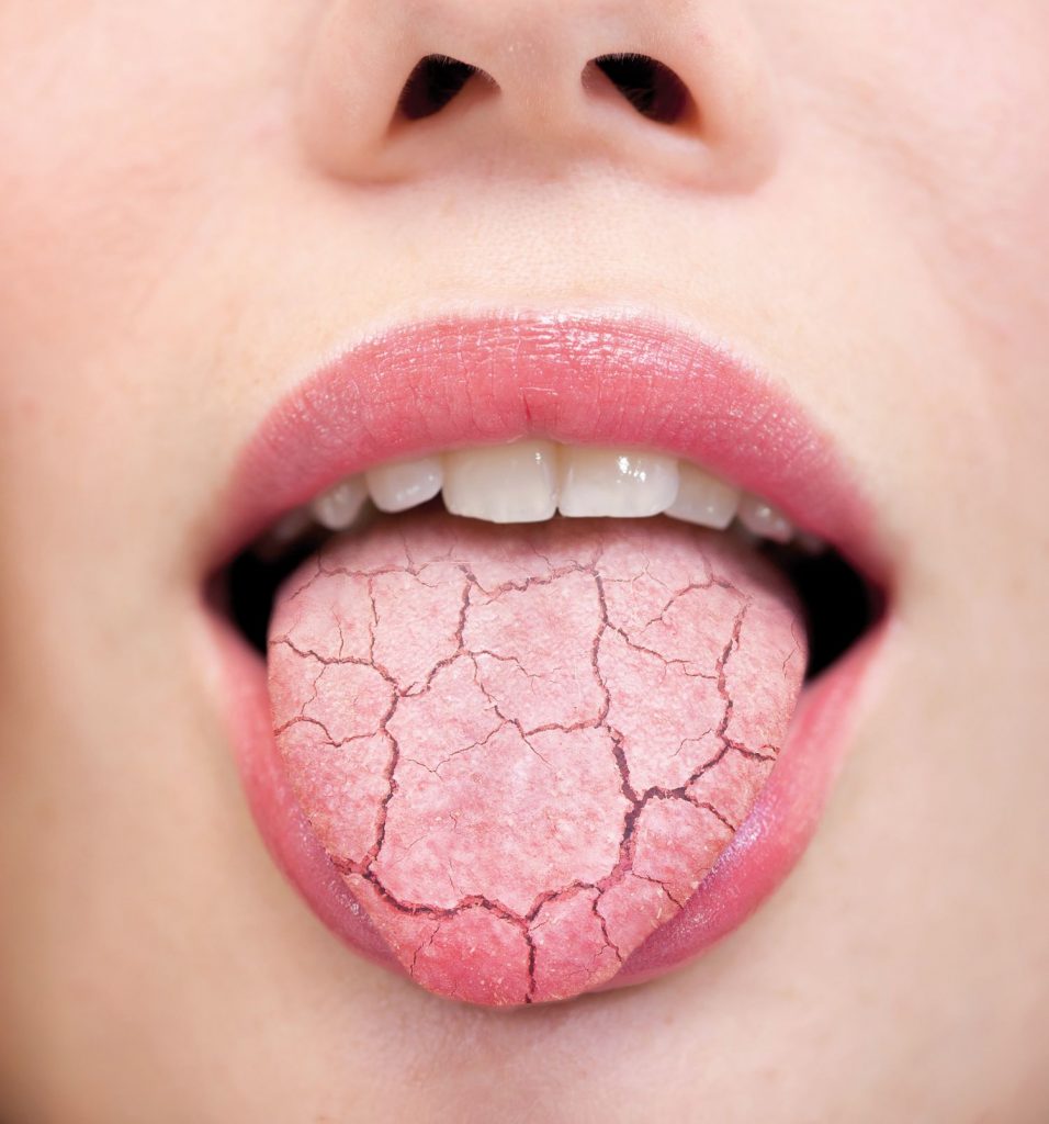 ¿Sequedad de boca? Mentiroso