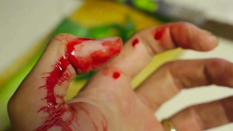 Cómo cortar la sangre de una herida