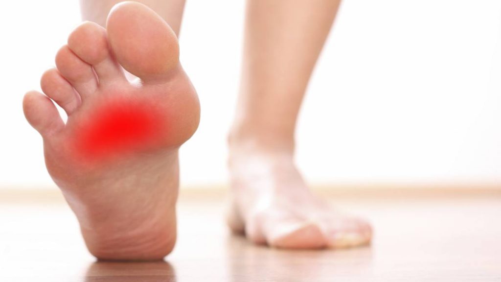 Cómo prevenir la fascitis plantar 47 Soluciones para la fascitis plantar