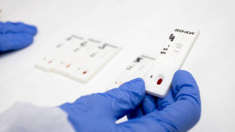 Navarra sube a 102 nuevos casos en el último día y notifica tres fallecimientos