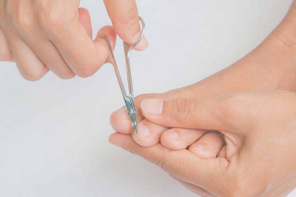 Cómo solucionar unas uñas encarnadas 5 Prevenir uñas encarnadas