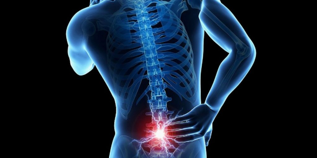 ¿Cuáles son los síntomas del Lumbago?