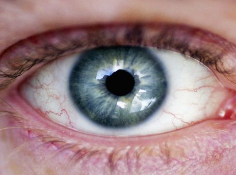 Cómo quitarte un cuerpo extraño del ojo Cómo quitarte un cuerpo extraño del ojo