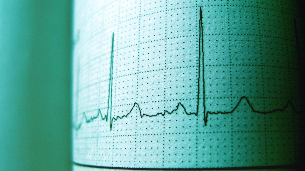 Frecuencia cardíaca