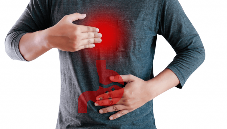 Cómo aliviar el reflujo gástrico