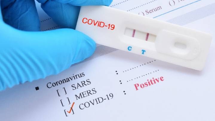Cómo hacerte un test Covid en las farmacias de Madrid