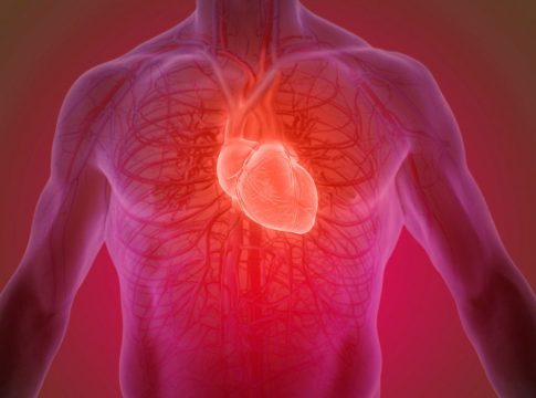 SOPLO EN EL CORAZÓN Qué es un soplo en el corazón