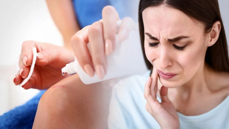 Agua oxigenada: todos los peligros que tiene en tu piel