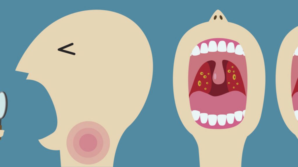 Enfermedades que se contagian por un beso