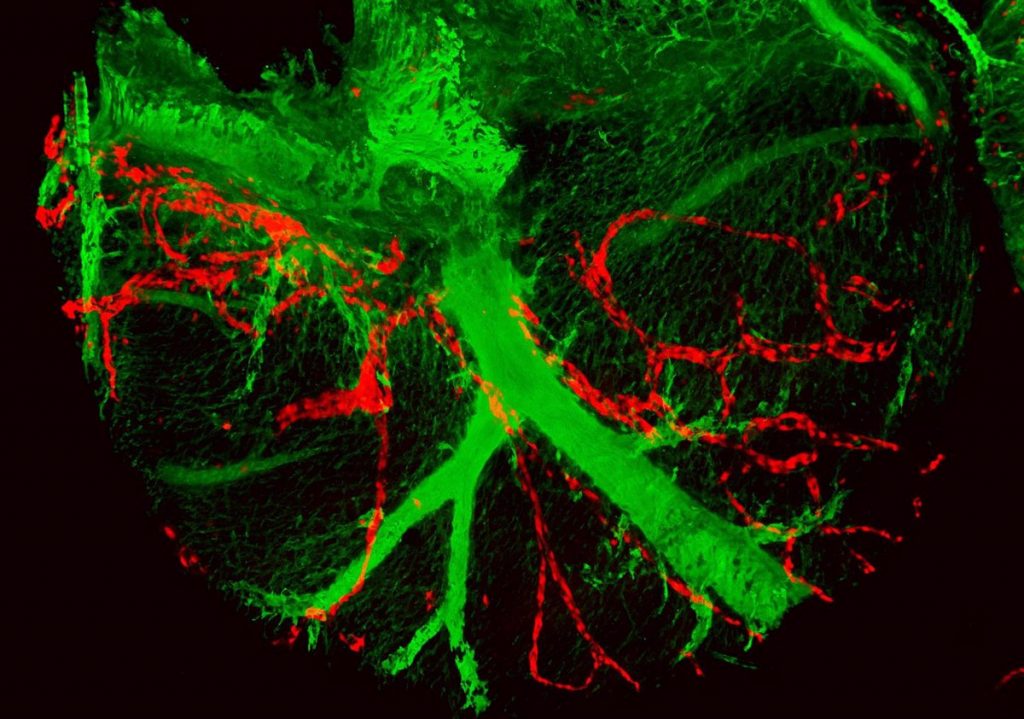 Qué es una angina de pecho 3 Arterias