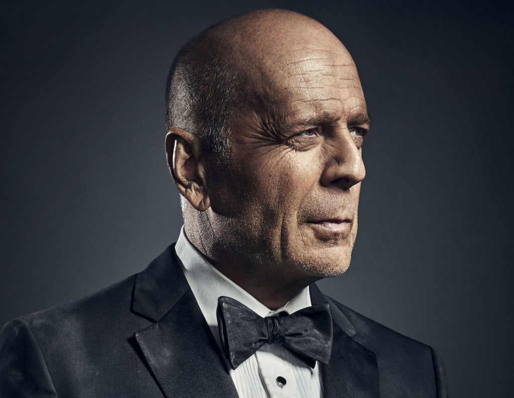 Por lo visto ser alopécico tiene otra serie de ventajas en cuanto a la salud.