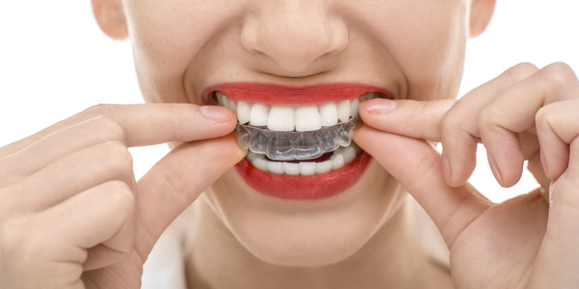 ¿Cuáles son los tratamientos para el bruxismo?