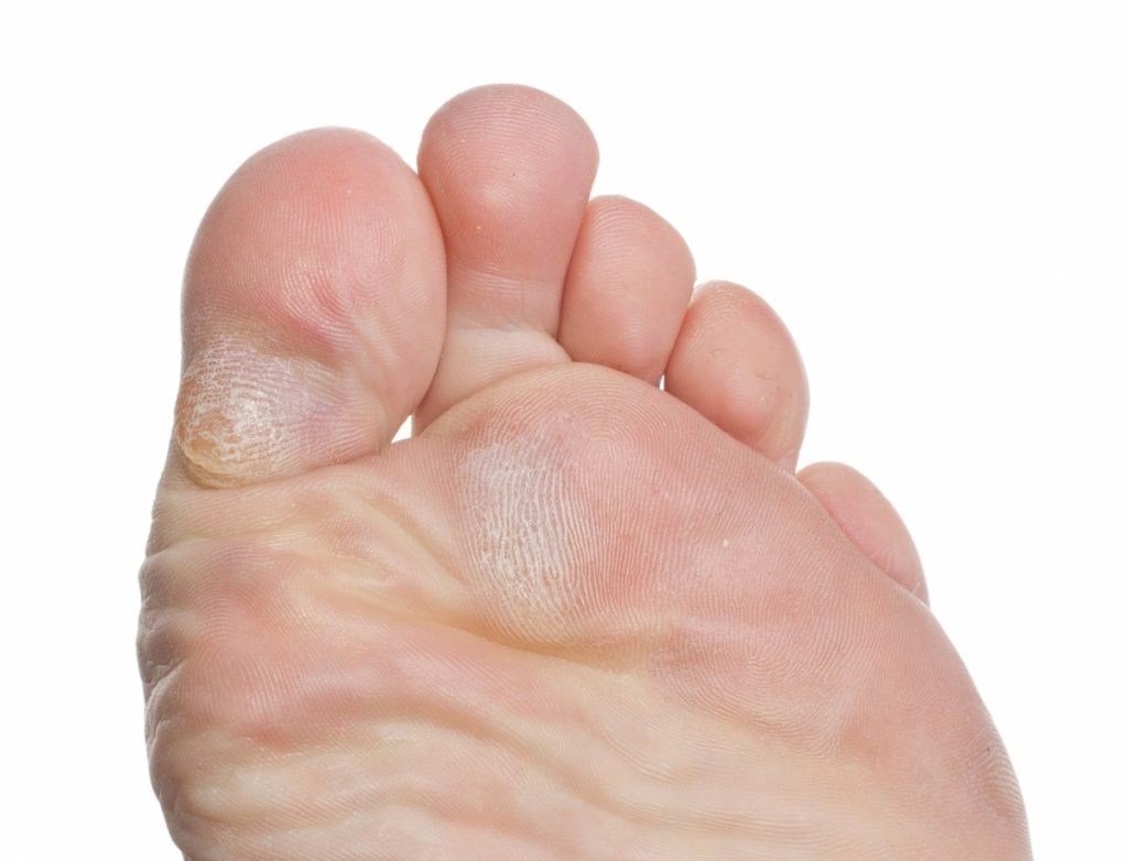 Aspirina: los otros usos más allá de un dolor de cabeza