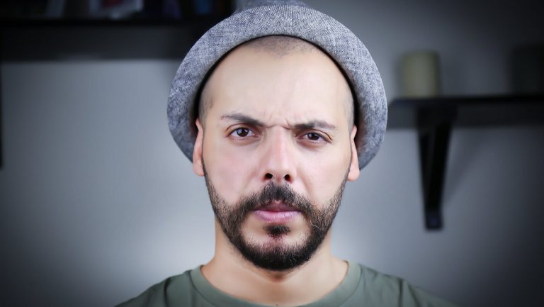 Señales inequívocas de que te estás quedando calvo