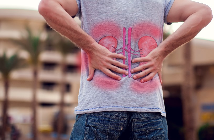 Síntomas y prevención de un cólico nefrítico