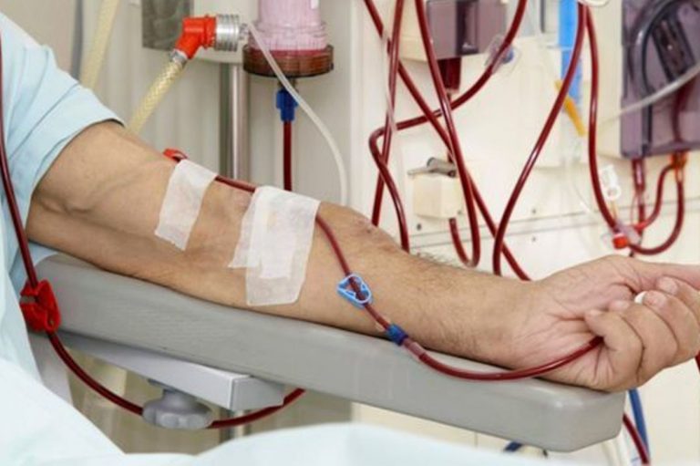 Qué es la diálisis