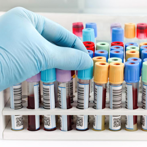 Por qué es necesario 