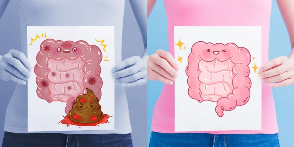 Cómo acabar con el estreñimiento 1 ¿Cuáles son las causas del estreñimiento?