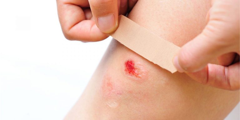 Cómo desinfectar una herida