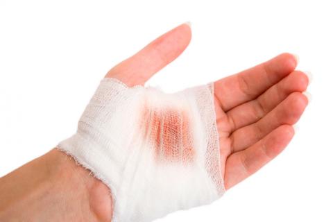 Qué es el clopidogrel 2 precauciones con el tratamiento de clopidogrel