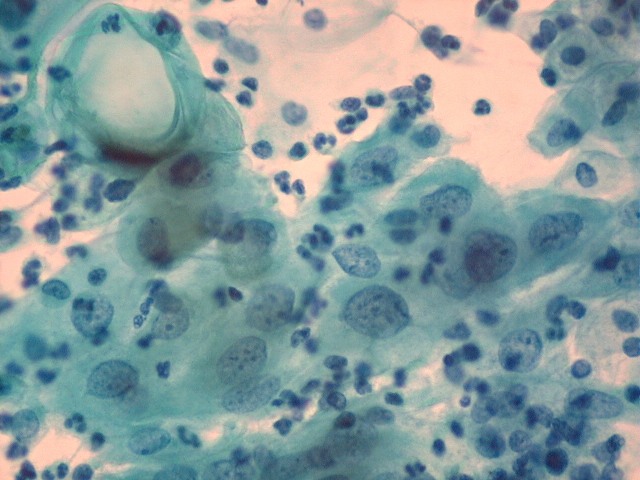 Qué es la mitosis 2 mitosis2