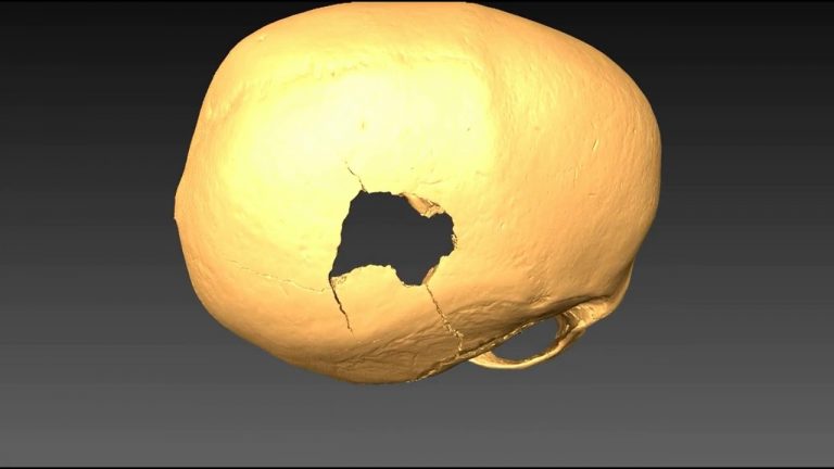 Identifican una muerte violenta de hace 5.000 años en el yacimiento de Cova Foradada