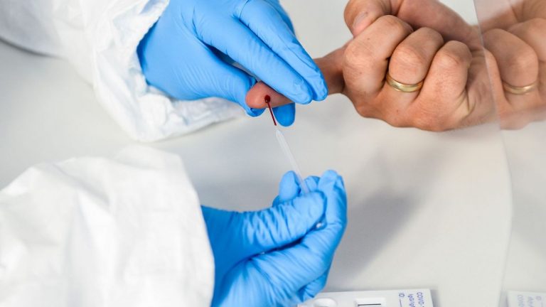 Navarra detecta 82 nuevos casos de Covid-19 y notifica 10 fallecimientos