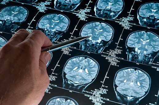 Origen de los trastornos neurológicos