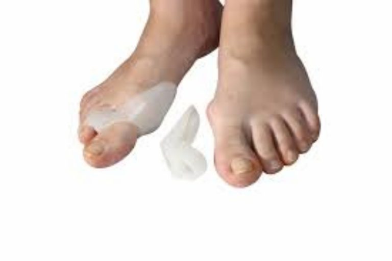 Cómo reducir los juanetes: ejercicios y remedios que funcionan