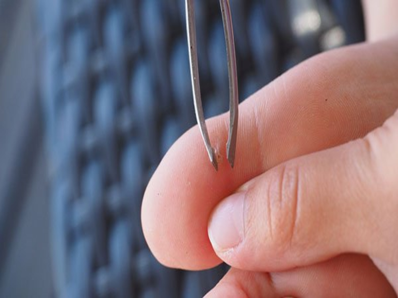 como quitar la astilla si esta a la vista