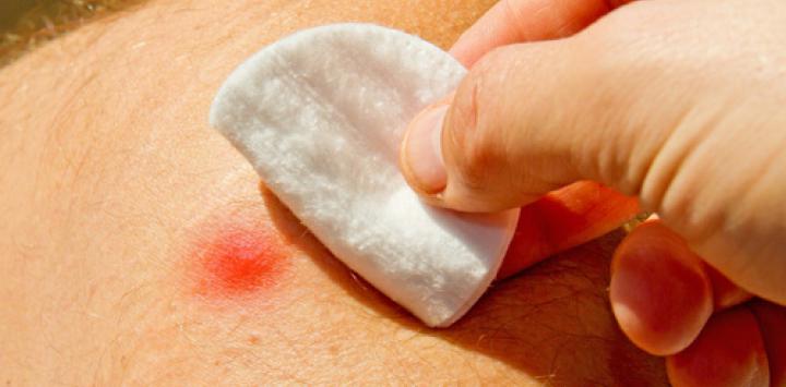 Causan efectos secundarios o daños