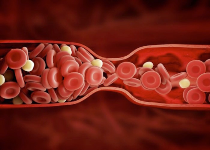 ¿Cómo se usa la heparina?