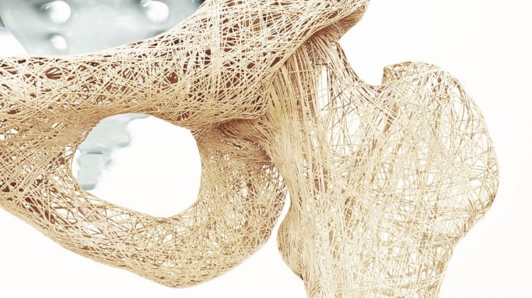 Alimentos que fortalecen los huesos para evitar la osteoporosis